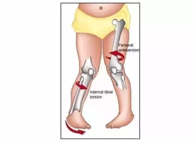 腳踝痛還繼續(xù)運動會怎么樣_疼腳踝能運動好后會疼嗎_運動后腳踝疼 多久能好