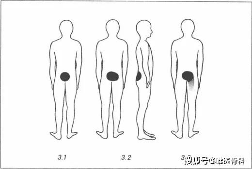 國(guó)內(nèi)反重力跑步機(jī)_0重力跑步機(jī)_alterg反重力跑步機(jī)官網(wǎng)