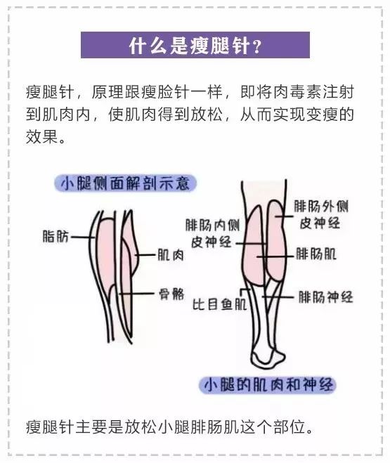 小腿肌肉打過(guò)瘦腿針圖_肌肉腿打了瘦腿針能保持多久_肌肉瘦腿針會(huì)反彈嗎