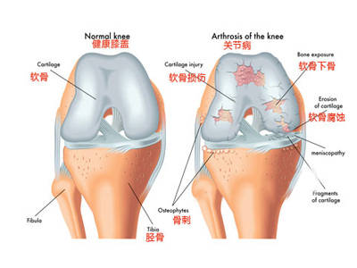 跑步擺腿動作要領(lǐng)_跑步的擺腿訓(xùn)練_跑步后擺腿教學(xué)